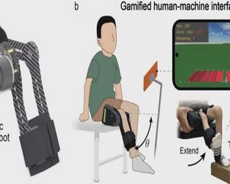 ربات پوشیدنی به کودکان مبتلا به SMA کمک کرد بدون کمک بایستند