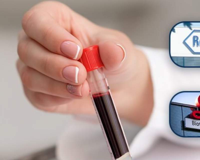 آزمایش خون رُش و ایلای لیلی برای کمک به شناسایی نشانه‌های آلزایمر مجوز FDA گرفت