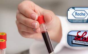 آزمایش خون رُش و ایلای لیلی برای کمک به شناسایی نشانه‌های آلزایمر مجوز FDA گرفت